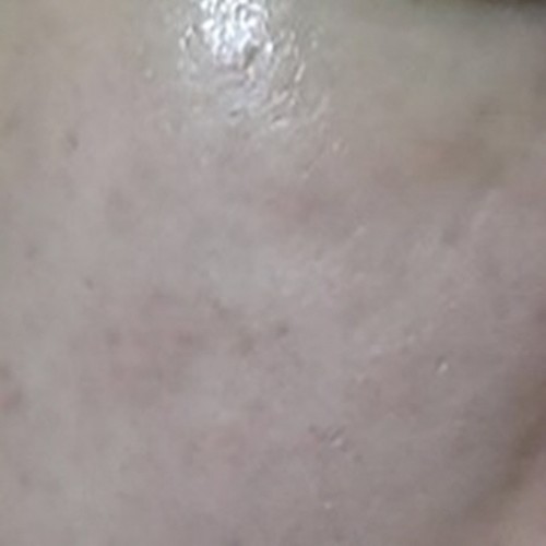 줄기세포 프로그램