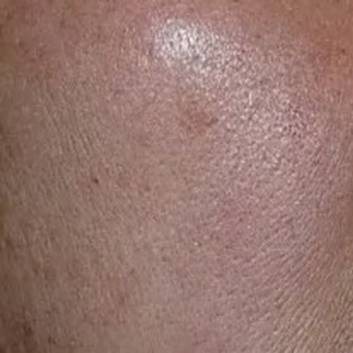 줄기세포 프로그램