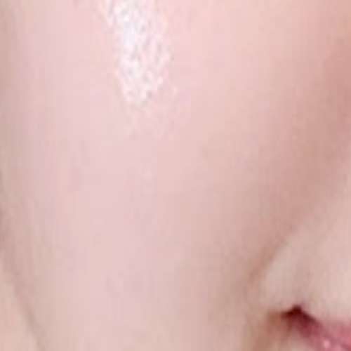 웨딩 프로그램 (리쥬란 물광  LDM 복합프로그램 3회)