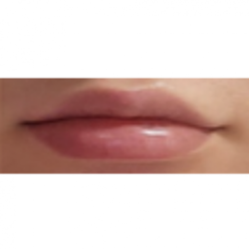에그볼륨 페이스 바디 필러 (입술)